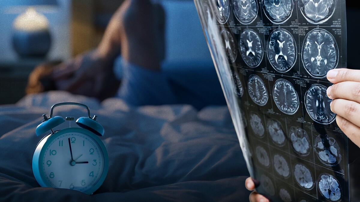Poor Sleep Can Lead to Mental Health Issues